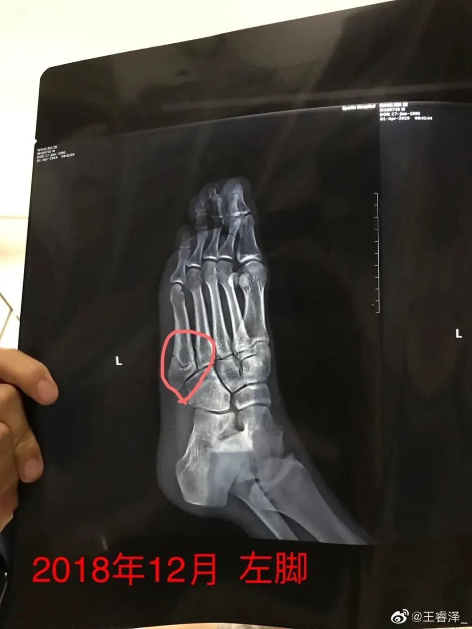 篮球老将如何通过瑜伽提升柔韧性_0
