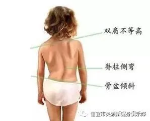 _2